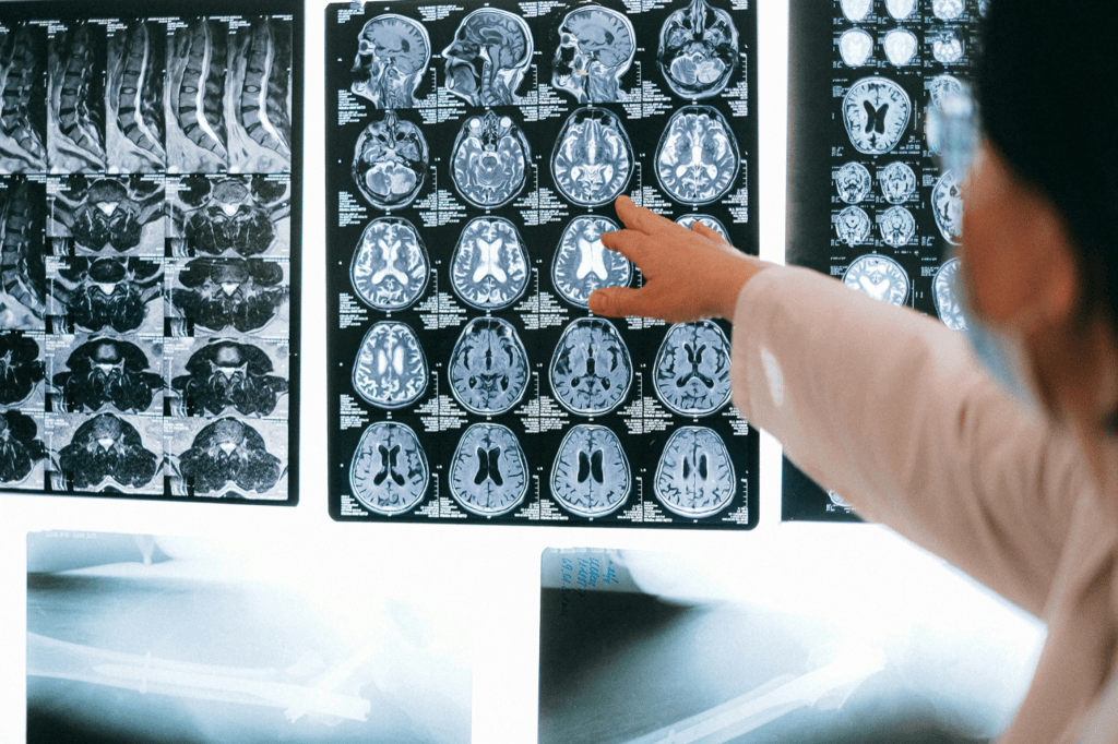 From diagnosis to chatbots: AI’s expanding role in autism&nbsp;care